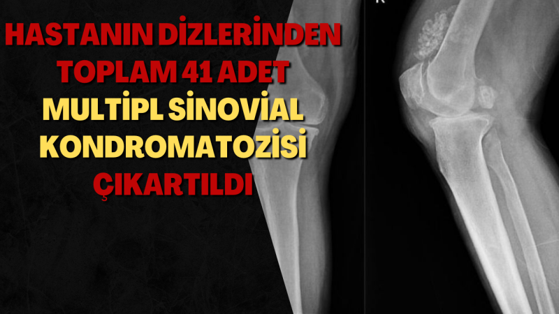 DİZİNDEN ÇIKAN EKLEM FARELERİ ŞAŞIRTTI